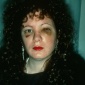 1984_Nan_Goldin_Nan_one_month_after_being_battered_1984